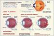 Manejo da retinopatia diabética Diretriz da Sociedad